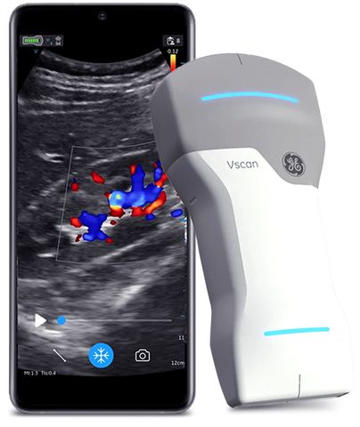 VScan Air&trade; CL
